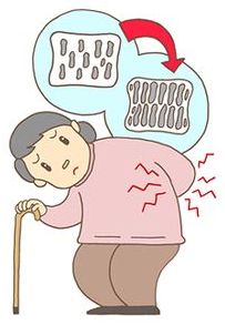 骨がもろくなり腰を痛めた高齢女性のイラスト