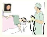 内視鏡検査室で検査を行う様子のイラスト